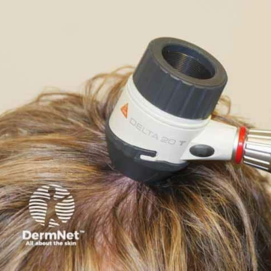 trichoscope-scalp-analysis-weymouth.png